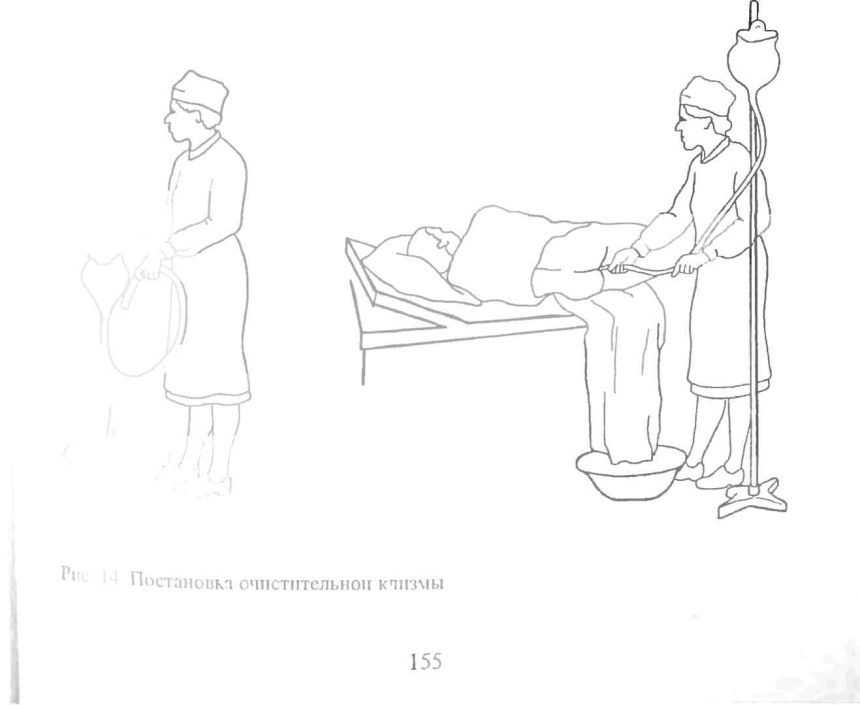 Для очистительной клизмы пациента укладывают на: