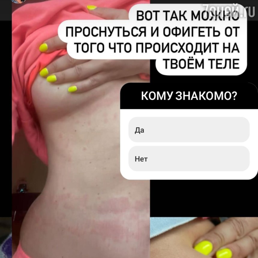 Наташа королёва позор