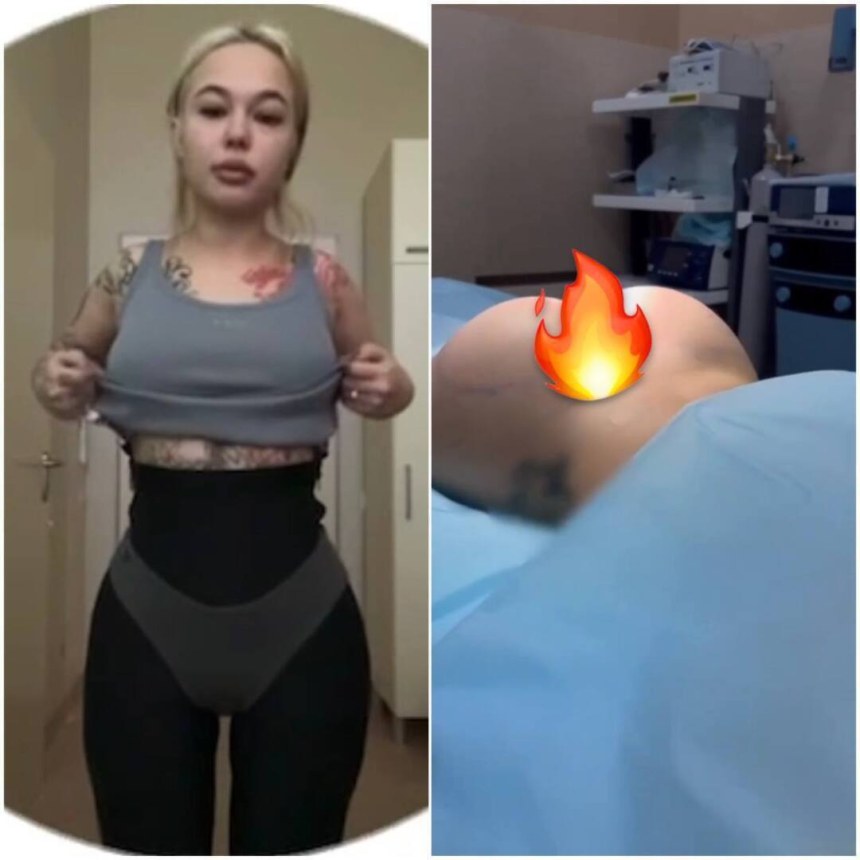 Инстасамка импланты