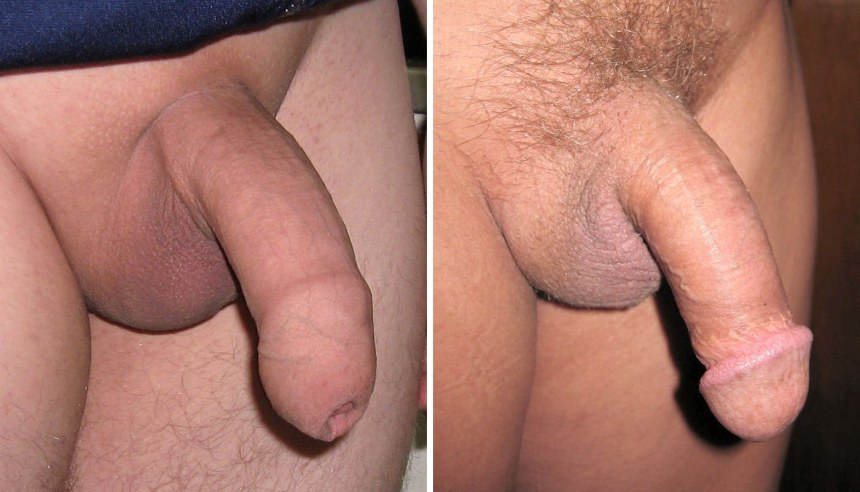 Мужской член до обрезания